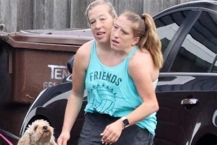 Abby And Brittany Hensel