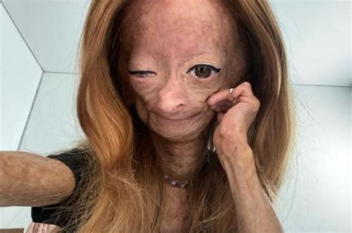 Adalia Rose