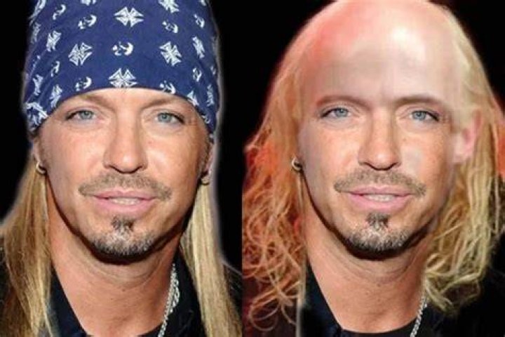 Bret Michaels Bald And Why Does He Always