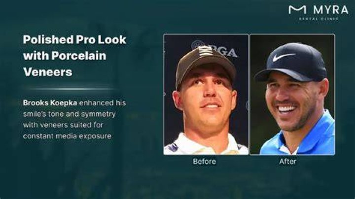 Brooks Koepka | Teeth Before And After