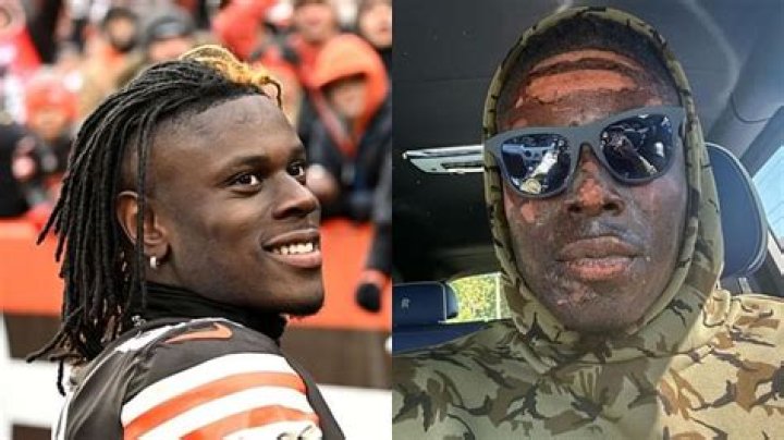 David Njoku Facial
