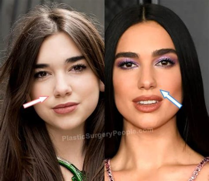 Dua Lipa Nose