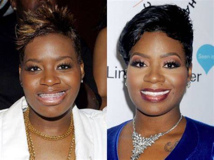 Fantasia Barrino | Did She Get Nose Job | Plastic Surgery