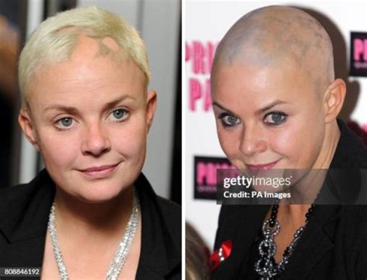 Gail Porter Bald