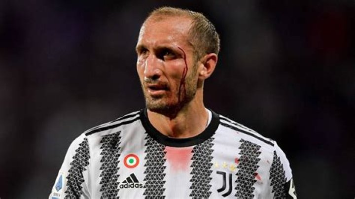 Giorgio Chiellini