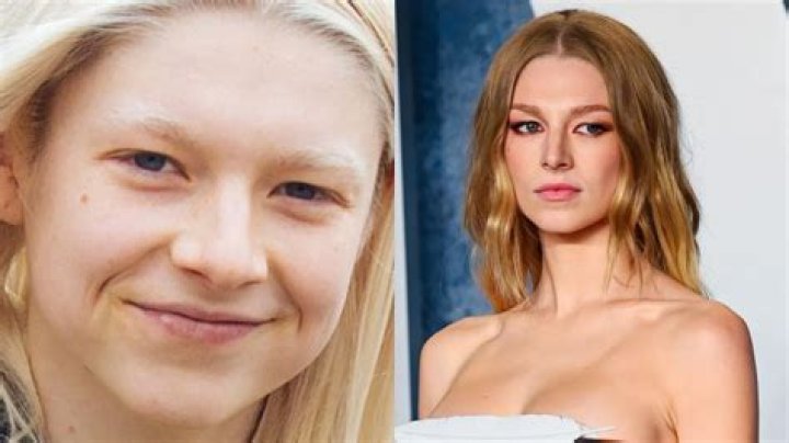 Hunter Schafer Surgery