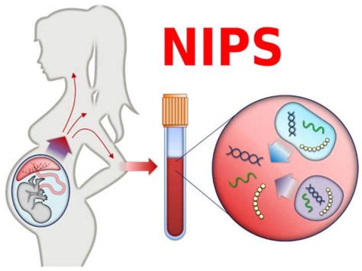 NIPS