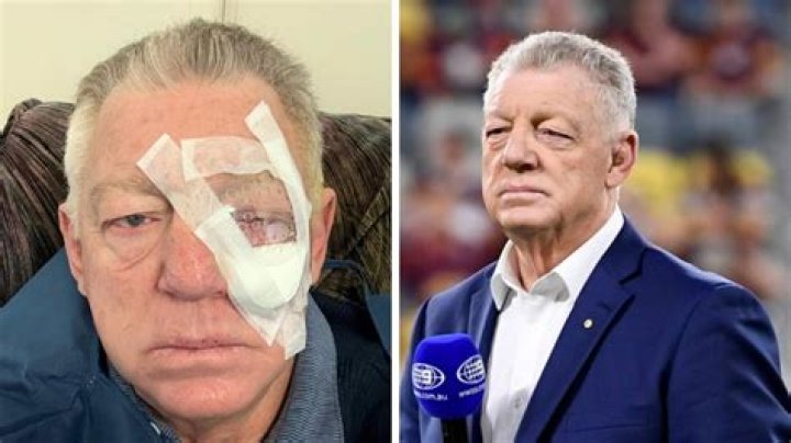 Phil Gould