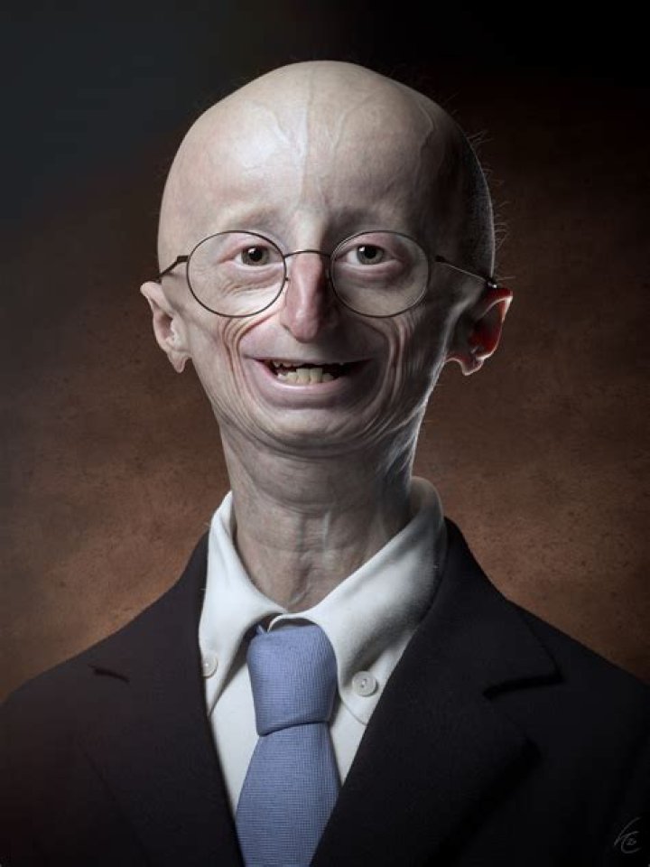 Sam Berns
