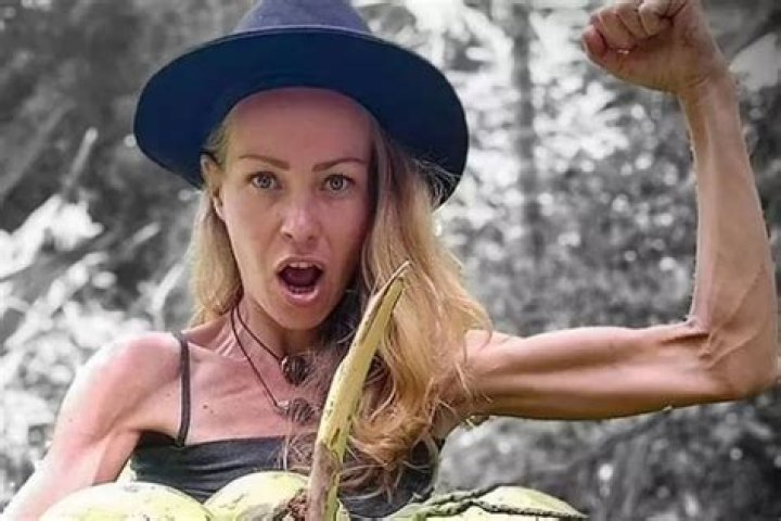 Zhanna Samsonova Anorexia
